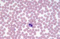 /album/paludismo/el-virus-de-la-malaria-en-la-s-54311086889-53389389549-600-396-jpg/